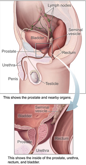 Prostatelead[1]