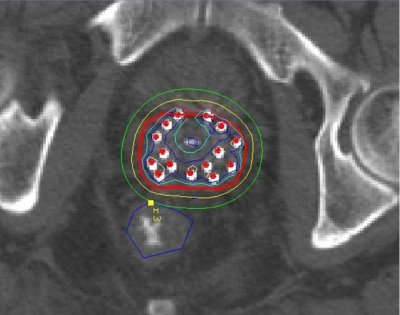 CT Scan